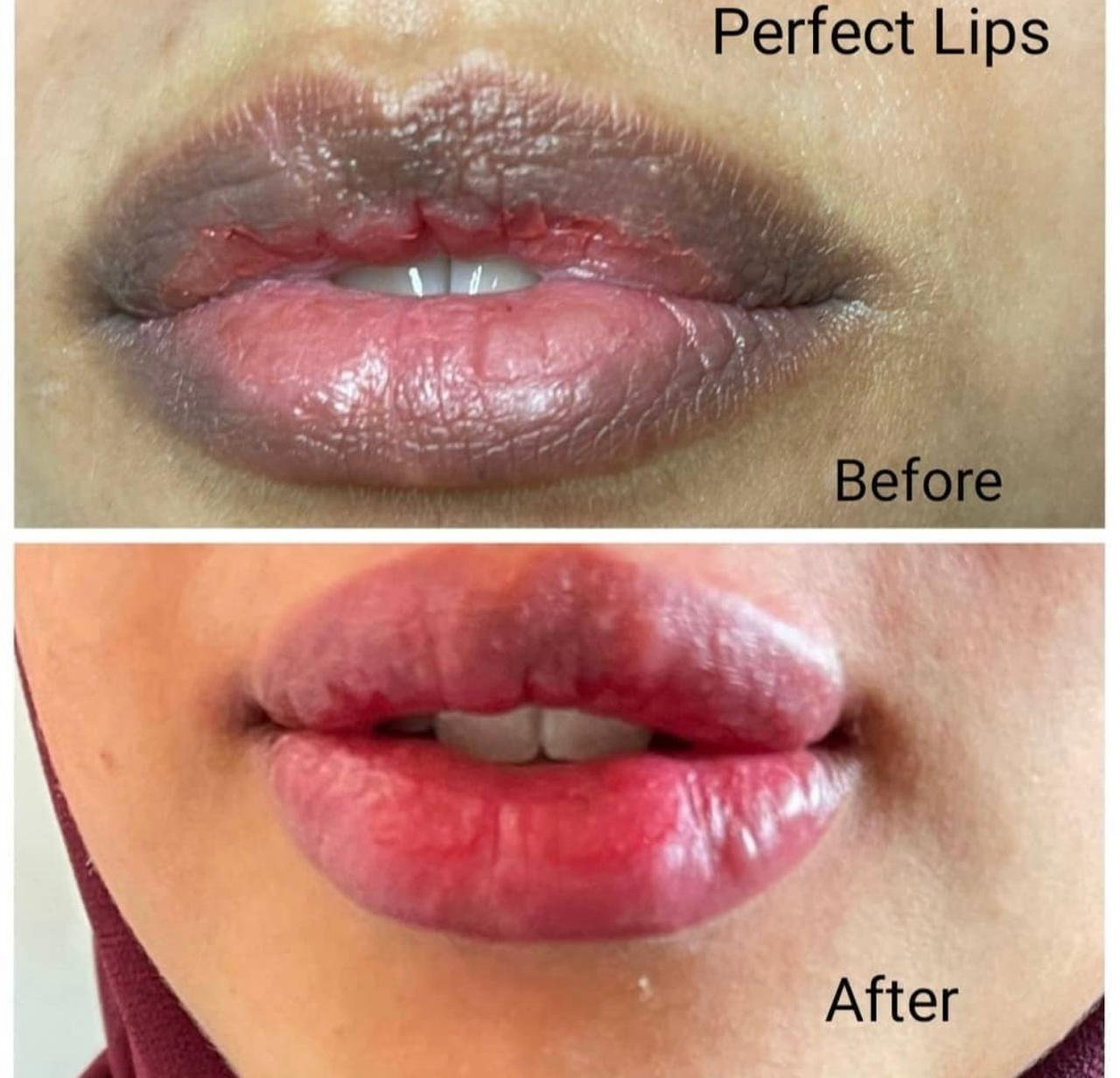 Perfect lips